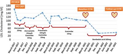 Case report: Strong low-density-cholesterol reduction accompanied by shrinkage of low-attenuation coronary plaque during lipid-lowering treatment with bempedoic acid—serial evaluation by coronary computed tomography angiography